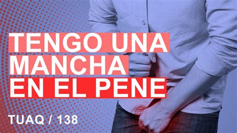 manchas en el pen negras|Manchas negras en el pene pueden ser cáncer